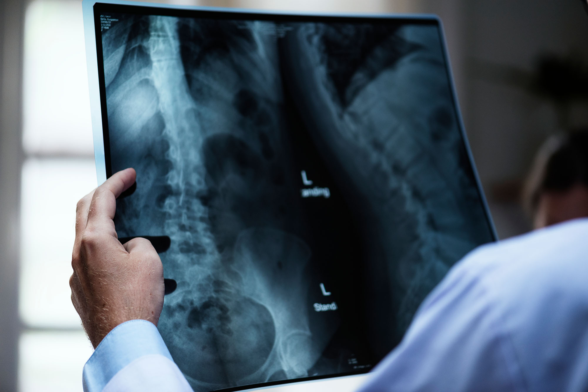 God’s Providence Though Spinal Fracture